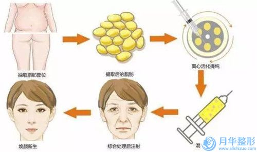 揭阳市爱笑唇整形真实费用-揭阳市爱笑唇整形价格行情