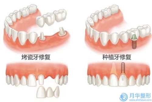 大理白族自治州做共振吸脂医生排行前十名实力贴发布-大理白族自治州做共振吸脂医生