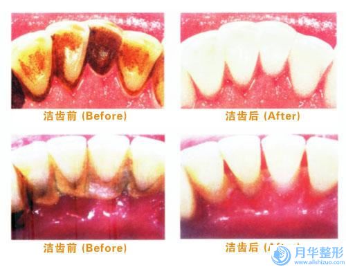 辽宁省臀部抽脂手术价格表(价目)在线一览-辽宁省臀部抽脂手术所需费用