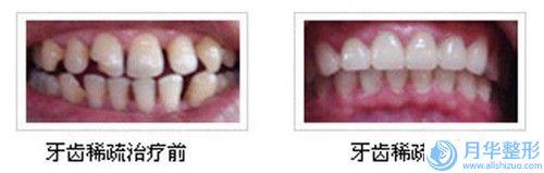 深圳市腰腹部吸脂瘦腰整形美容科价格表（价目）发布-近8个月均价为14712元