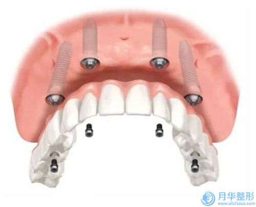 瘦腿抽脂一般会出现哪些后遗症_瘦腿抽脂后遗症具体有哪些