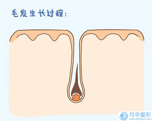 衢州市双平面动感丰胸整形价格表公开-衢州市双平面动感丰胸价格详解