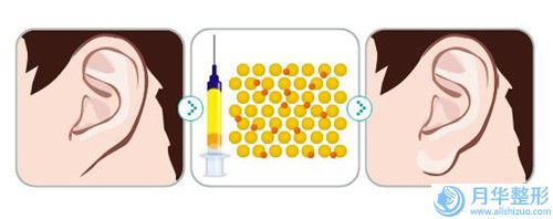 大连副乳手术手术价格是多少呐,大连副乳手术手术的价格会不同吗