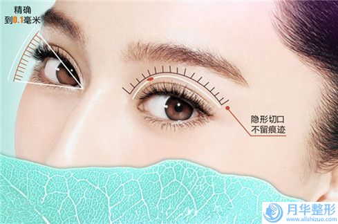 2023年湖北省眼睑疤痕修复价格表抢鲜价格出炉（湖北省眼睑疤痕修复手术要多少钱左右）