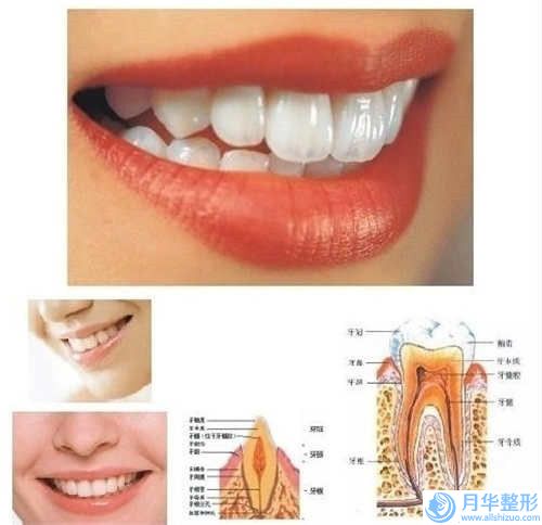 东莞共振吸脂瘦臀的费用会受什么影响呢