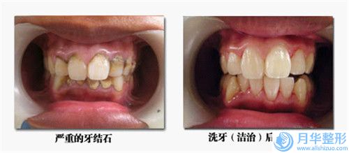 岳阳市上臂吸脂整形医院排行榜十强震撼发布-岳阳你美医疗美容门诊部有限公司收费合理推荐