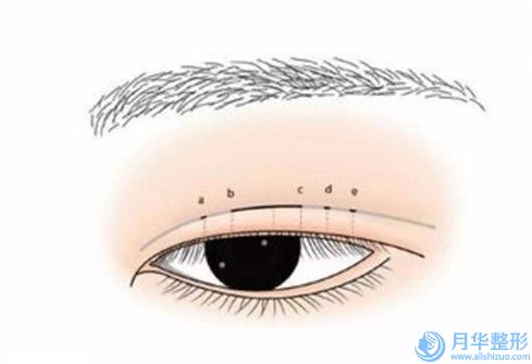 海南省自体脂肪营造卧蚕医院排行榜前10口碑曝光（海南省自体脂肪营造卧蚕整形医院）