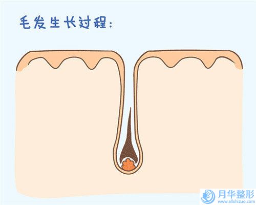 广州市脸上雀斑治疗价格表全面上线-广州市脸上雀斑治疗均价为1651元