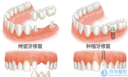 阳江市中药减肥医生在榜名单前十强实力评比-黄春晓医生低调入围