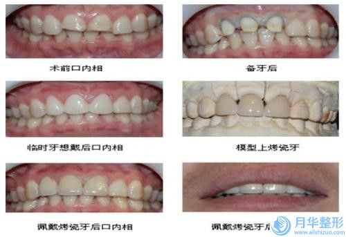 沈阳市溶脂瘦小腿收费标准惊喜放送(溶脂瘦小腿需要价格大约是多少)