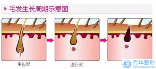 贵港面部激光去黄褐斑手术一般价格是多少