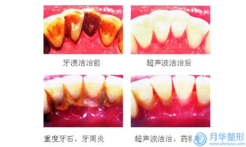 国内肚子激光溶脂医院哪里好：肚子激光溶脂医院50强知名度汇总