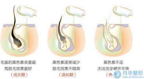 重庆市超薄贴面牙收费标准详细版本一览-重庆市超薄贴面牙价格