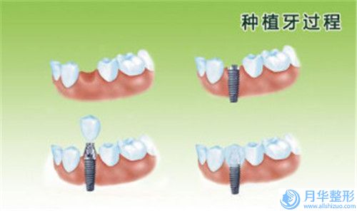 淄博市臀部环吸脂费用表明细，知名专家坐诊-齐鲁石化中心医院整形科价格表(费用)