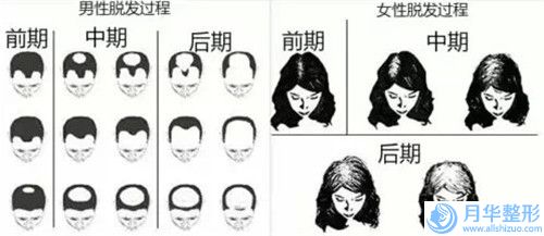 汉中三二Ｏ一医院医学美容外科小耳畸形造成的大小脸整形价格是多少钱呢