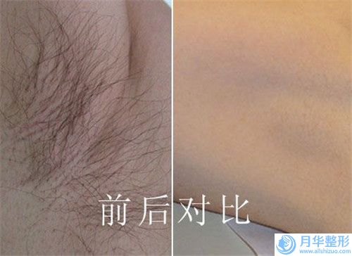 好面部冷冻溶脂机构推荐：面部冷冻溶脂医院前20位汇总盘点