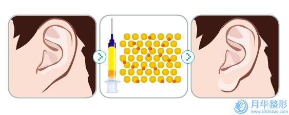 中国抽脂副乳医院推荐：抽脂副乳医院top50清单出炉