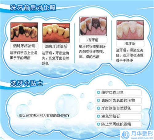 中国手臂抽脂环吸医院比较正规：手臂抽脂环吸医院前50强名单自查