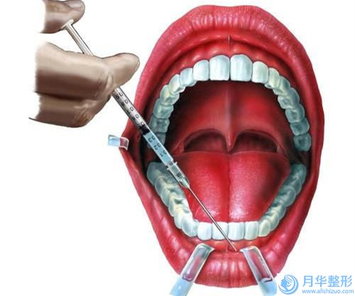 常州市光纤溶脂肚子价格价位表重磅一览-常州市光纤溶脂肚子手术费用具体多少