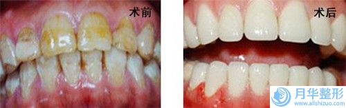 淄博腹部溶脂手术价格与什么有关呢