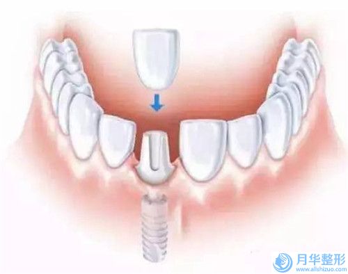 中国吸脂减大腿安全的整形医院：吸脂减大腿医院top50强权威资料