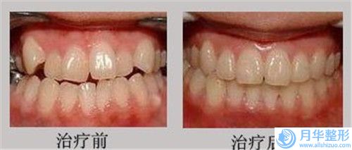 淄博市知名肥瘦腰机构-淄博市肥瘦腰医院排行榜任你挑