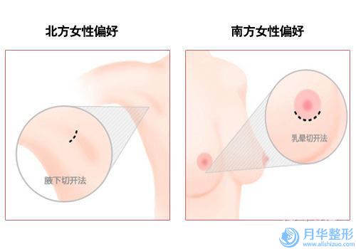 中国额头拉皮除皱医院推荐：额头拉皮除皱医院前50哪几家可靠