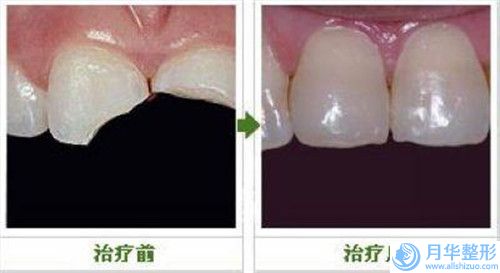 腹壁抽脂医院推荐：腹壁抽脂医院强榜前30强为您介绍