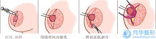 宜昌市丰额手术医生较好的是哪个-戴本华整形医生口碑出众技术前沿