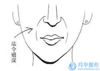 江西省凹陷疤痕治疗手术价格收费表全新版倾情巨献-江西省凹陷疤痕治疗手术大概费用要多少