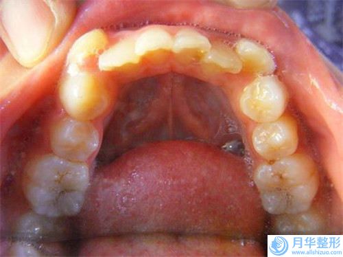 全国抽脂减肥术医院推荐：抽脂减肥术医院前50标准版