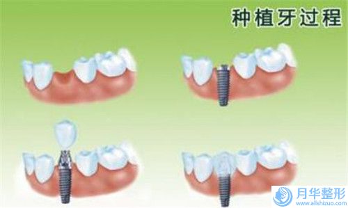 国内全臀部吸脂整形医院：全臀部吸脂医院前50强实力比较好