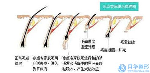 南宁科之美医疗美容门诊部全脸面部吸脂费用是少钱呢