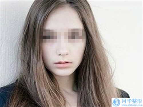 石家庄市用填充下巴医院在榜清单top10强女生必看名单-石家庄怡美医疗整形门诊部