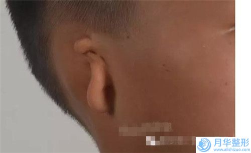 男性乳房整形医院推荐：男性乳房整形医院前30提前预告